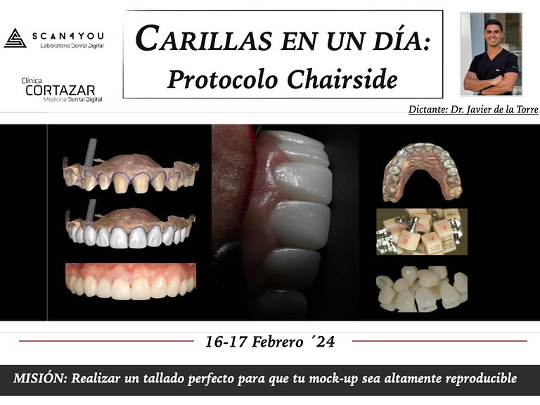 Curso “CARILLAS EN UN DÍA. PROTOCOLO CHAIRSIDE” en Clínica Dental Cortázar junto a Scan4you Málaga